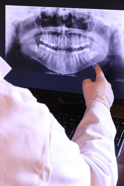Best Emergency Tooth Extraction in Leslie, MI